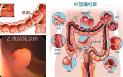 泉州糜烂性胃炎治疗较好的医院是哪家